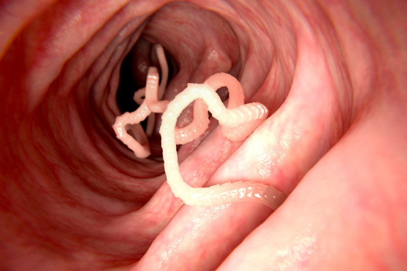 parasitic resistance