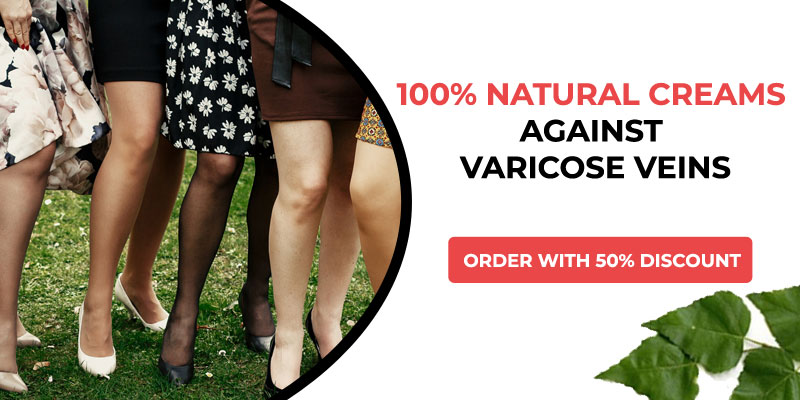 varicose veins on buttocks